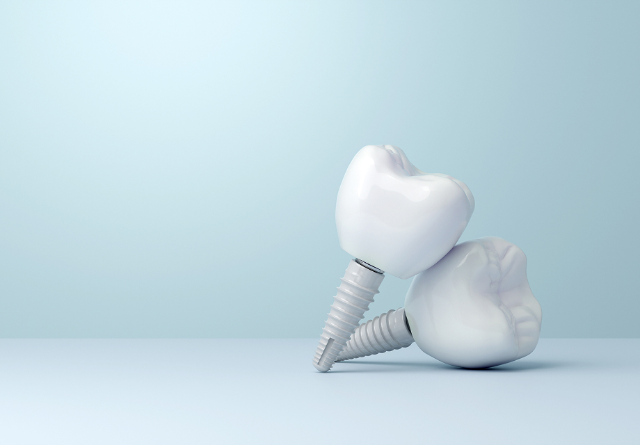 ceramic dental implants
